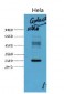 Galectin-3 Monoclonal Antibody(6G2)